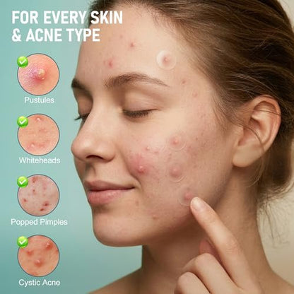 TKGOU Pimple Patches for Face - 1250 Counts 3 Size Acne Patches, Hydrocolloid Spot Stickers for All Skin Types - Invisible Zit Patches to Shrink Blemishes & Breakouts
