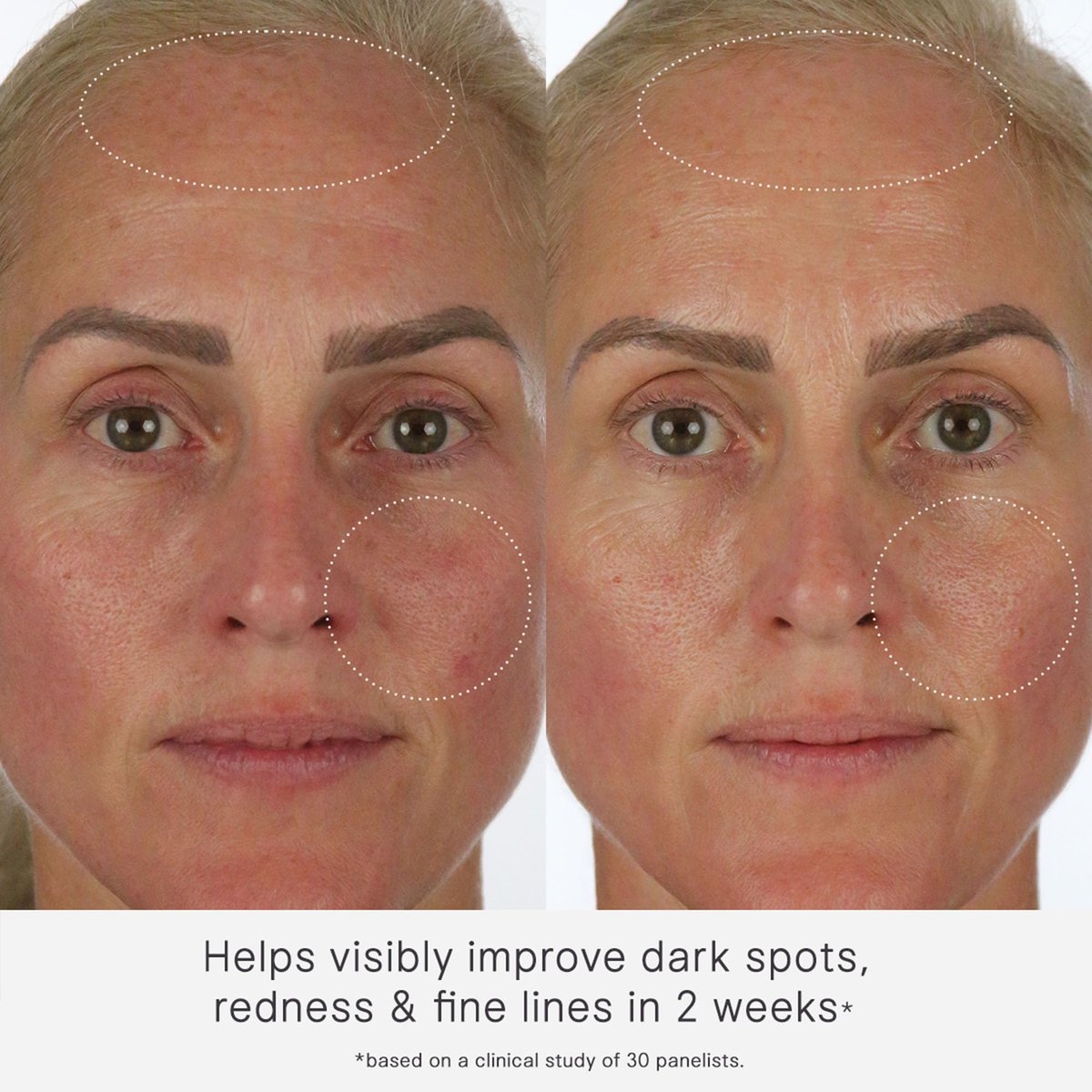 TATCHA The Milky Sunscreen Broad Spectrum SPF 50+ PA+++ - Daily Light-Weight Sun Protection with No White Cast, Visible Sun Damage Correction for All Skin Types with Ectoin, Vitamin E, and Aloe Avelisse