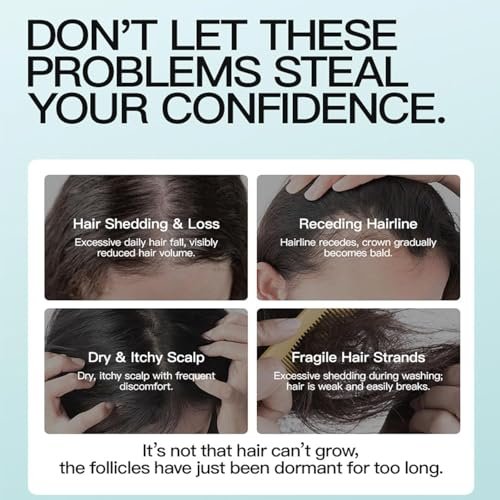 5% Minoxidil Hair Growth Scalp Massage Cream with Rosemary & Biotin - Professional Anti Hair Loss Treatment for Men & Women - görsel 5