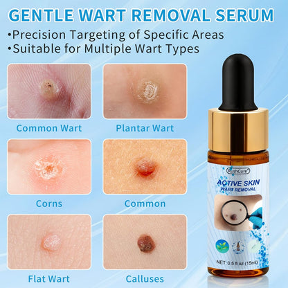 RushCure Skin Wart Remover with 17% Salicylic Acid - Fast Acting Mole Remover Serum for Plantar, Common & Flat Warts, Gentle Formula with Precision Dropper, Travel Size (0.5 Fl Oz) Avelisse