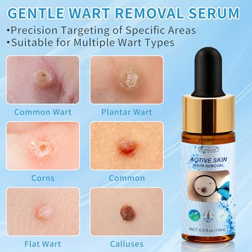 RushCure Skin Wart Remover with 17% Salicylic Acid - Fast Acting Mole Remover Serum for Plantar, Common & Flat Warts, Gentle Formula with Precision Dropper, Travel Size (0.5 Fl Oz) Avelisse