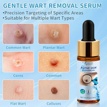 RushCure Skin Wart Remover with 17% Salicylic Acid - Fast Acting Mole Remover Serum for Plantar, Common & Flat Warts, Gentle Formula with Precision Dropper, Travel Size (0.5 Fl Oz) Avelisse