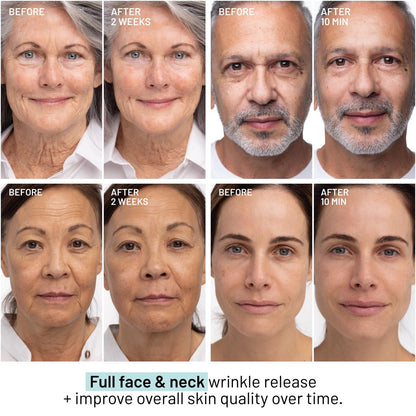 Dr. Brandt Needles No More Wrinkle Release Serum - Targets Expression Lines & Wrinkles, Immediate Smoothing, Supports Collagen - 1 fl oz Avelisse