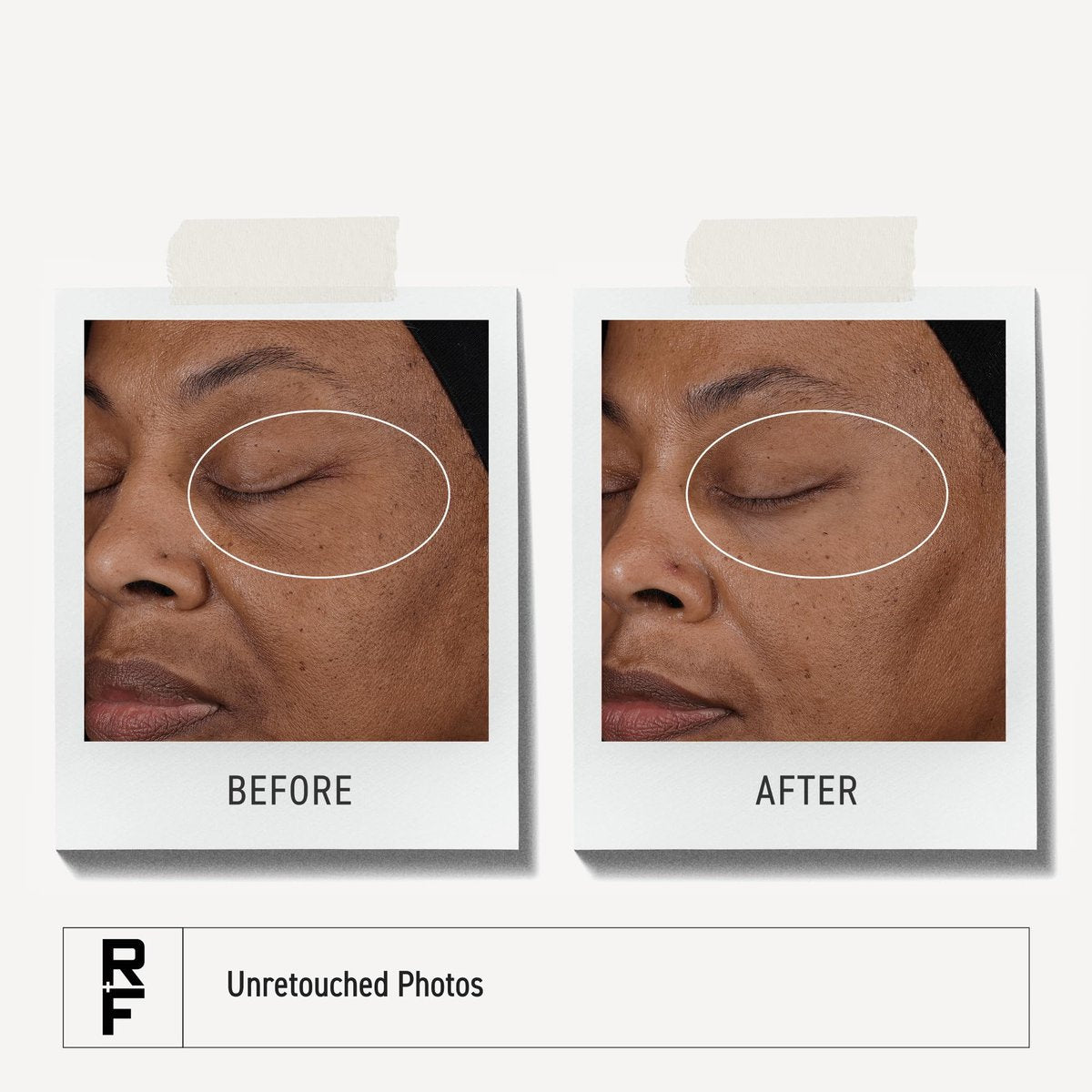 Rodan + Fields Pure C Serum | 10% Ascorbic Acid Vitamin C Formula for Refined-Looking Skin | Antioxidant Support | Water-Free | Non-Comedogenic Facial Serum Avelisse