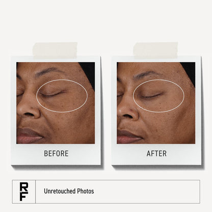 Rodan + Fields Pure C Serum | 10% Ascorbic Acid Vitamin C Formula for Refined-Looking Skin | Antioxidant Support | Water-Free | Non-Comedogenic Facial Serum Avelisse