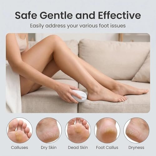 Foot Dead Skin Remover - Heel Callus Care Shaver for Removing Dead Skin, Hard Skin & Calluses Avelisse