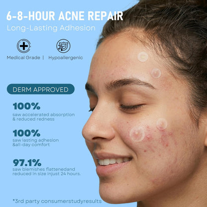1250 Count Pimple Patches for Face - 3 Sizes (8mm, 10mm, 12mm) Hydrocolloid Acne Patches, Cute Round Acne Stickers, Covers Zits, Blemishes & Breakouts – Gentle on All Skin Types