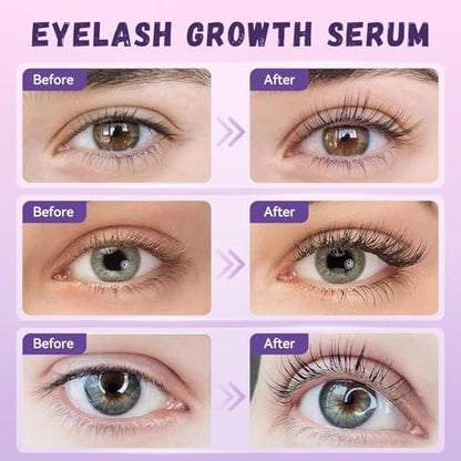 Lash Growth Serum - Gentle Daily Nourishing Treatment for Longer Thicker Fuller Lashes - Vegan Cruelty-Free Sensitive Eyes Safe (5ml) Avelisse