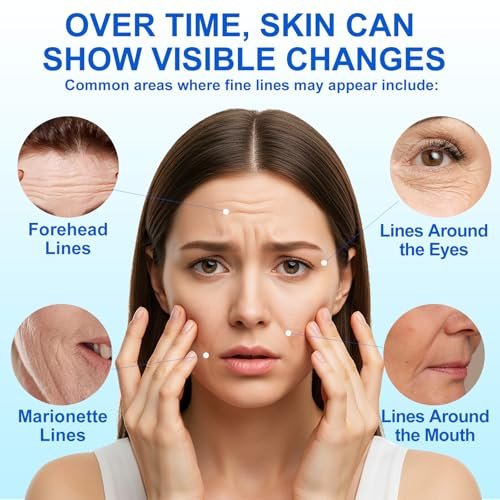 XCTTDXEH Triangle Wrinkle Patches for Eyes, Mouth, Forehead – 288 Hypoallergenic Anti-Wrinkle Pads for Elevens & Crow's Feet Avelisse