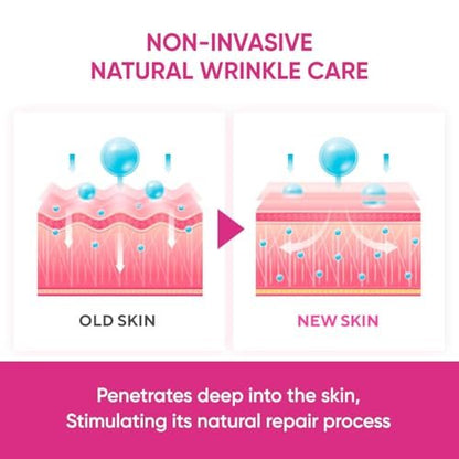 SILKDERMIS Facial Wrinkle Patches – Overnight Anti-Wrinkle Patches for Forehead & Face (144 Count) Avelisse