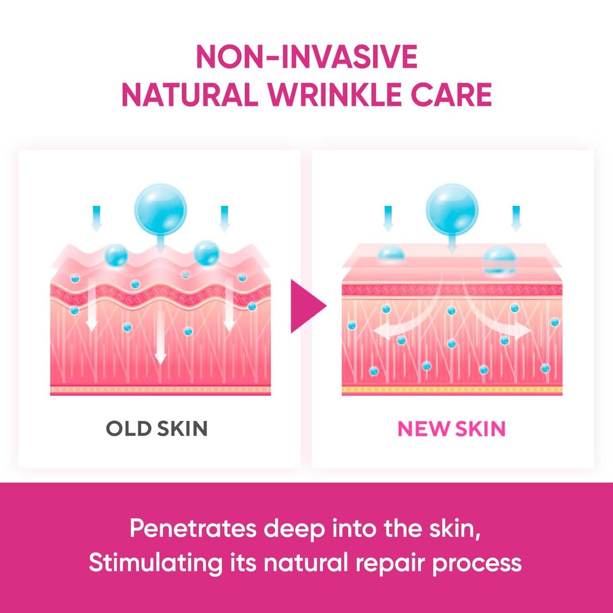 SILKDERMIS Facial Wrinkle Patches – Overnight Anti-Wrinkle Patches for Forehead & Face (144 Count) Avelisse