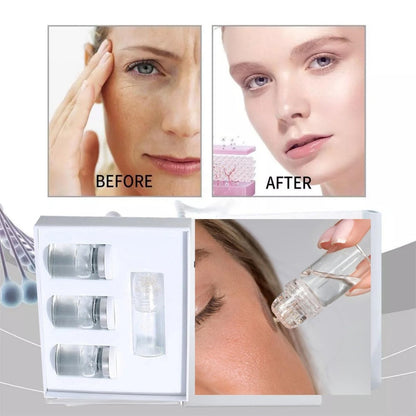Saranova Micro Infusion System for Face - Moisturizing Serum & Stamp Kit for Hydrated, Smooth Skin (1-Month Supply) Avelisse