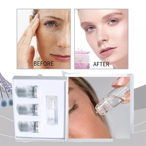 Saranova Micro Infusion System for Face - Moisturizing Serum & Stamp Kit for Hydrated, Smooth Skin (1-Month Supply) Avelisse