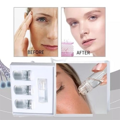 Saranova Micro Infusion System for Face - Moisturizing Serum & Stamp Kit for Hydrated, Smooth Skin (1-Month Supply) Avelisse