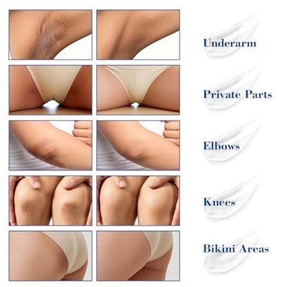 MyTend Skin Bleaching Cream - Intimate Area Lightening Cream for Inner Thighs, Bikini Line, Underarms, Elbows & Knees - Hydrating Whitening Body Cream - 1.7 Fl Oz Avelisse