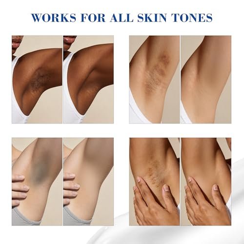 MyTend Skin Bleaching Cream - Intimate Area Lightening Cream for Inner Thighs, Bikini Line, Underarms, Elbows & Knees - Hydrating Whitening Body Cream - 1.7 Fl Oz Avelisse