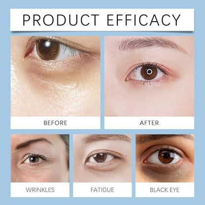 Instant Firming Eye Serum – Anti-Aging Under Eye Cream for Bags, Dark Circles, Puffiness & Wrinkles – Visibly Reduces Fine Lines & Crow's Feet with Wrinkle Filler Formula