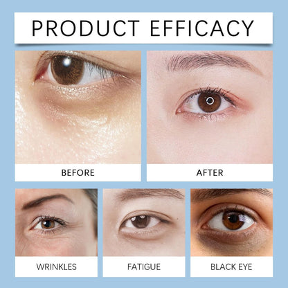 Instant Firming Eye Serum – Anti-Aging Under Eye Cream for Bags, Dark Circles, Puffiness & Wrinkles – Visibly Reduces Fine Lines & Crow's Feet with Wrinkle Filler Formula