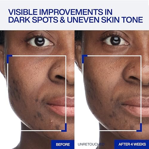 IOPE Expert Vitamin C 40% Concentrate Cream – High Potency Waterless Face Cream for Dark Spots, Uneven Tone, and Fine Lines (0.67 fl. oz.) Avelisse