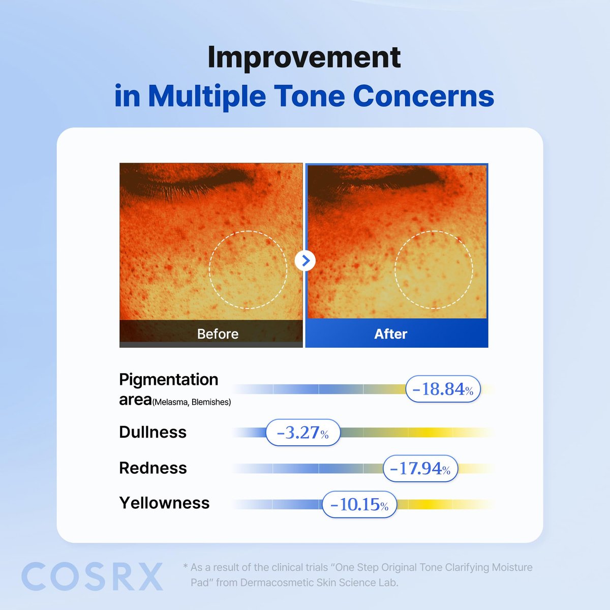 COSRX OneStep Original Tone Clarifying Moisture Pad - 100 Pads Daily Toning Pad for Skin Texture, Hydration & Evening Skin Tone with Arbutin, Glutathione & 12 Hyaluronic Acids - görsel 7