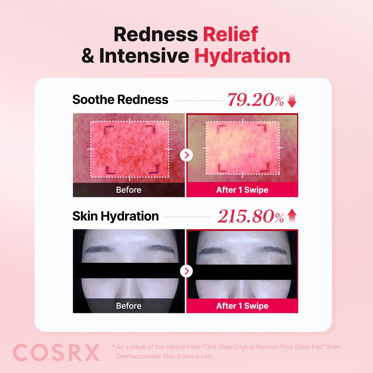 COSRX OneStep Original Blemish Pore Clear Pad – 100 Pads, Dual-Sided Exfoliating & Hydrating Facial Pad with BHA, PHA, Zinc PCA & 5 Hyaluronic Acids - görsel 7