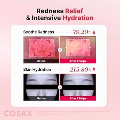 COSRX OneStep Original Blemish Pore Clear Pad – 100 Pads, Dual-Sided Exfoliating & Hydrating Facial Pad with BHA, PHA, Zinc PCA & 5 Hyaluronic Acids