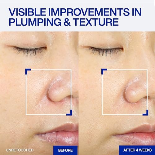 IOPE XMD Stem III Clinical Recovery Serum - Professional PDRN Treatment-Level Results - Visibly Firms, Plumps Volume, and Refines Pores - with Hyaluronic Acid - 1.01 fl. oz. Avelisse