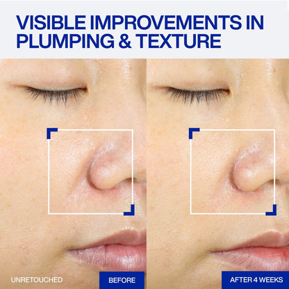 IOPE XMD Stem III Clinical Recovery Serum - Professional PDRN Treatment-Level Results - Visibly Firms, Plumps Volume, and Refines Pores - with Hyaluronic Acid - 1.01 fl. oz. Avelisse