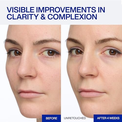 IOPE Expert Vitamin C 25% Antioxidant Serum - 25% Pure Vitamin C for Even Skin Tone, Radiance & Smooth Texture with 5 Antioxidants and PHA - 0.77 fl. oz. Avelisse