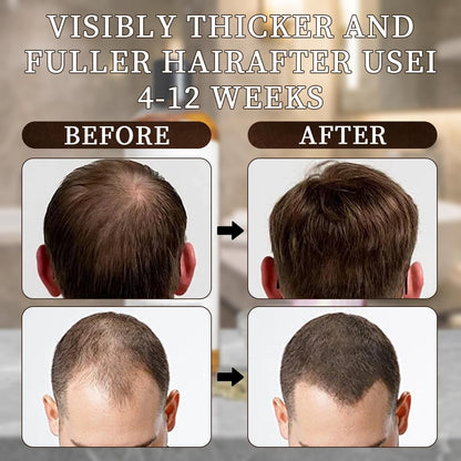 LEDeng Excalvo Shampoo - Rosemary Oil & Red Onion & Cinnamon Extract for Hair Growth, Stronger, Thicker, Longer Hair for Women & Men Avelisse