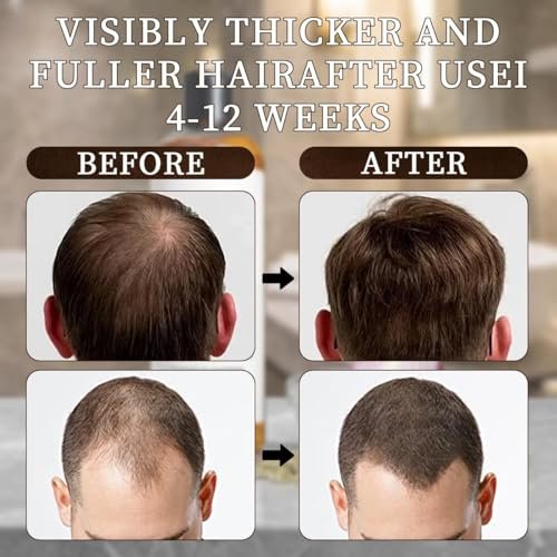 LEDeng Excalvo Shampoo - Rosemary Oil & Red Onion & Cinnamon Extract for Hair Growth, Stronger, Thicker, Longer Hair for Women & Men Avelisse