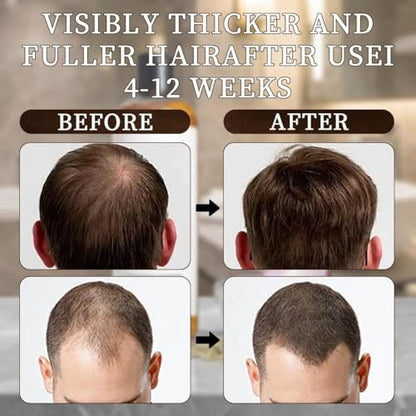 LEDeng Excalvo Shampoo - Rosemary Oil & Red Onion & Cinnamon Extract for Hair Growth, Stronger, Thicker, Longer Hair for Women & Men Avelisse