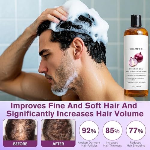 LEDeng Excalvo Shampoo - Rosemary Oil & Red Onion & Cinnamon Extract for Hair Growth, Stronger, Thicker, Longer Hair for Women & Men Avelisse