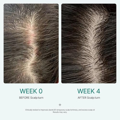 lilyeve SCALPTURN Cica PDRN Scalp Serum with Built-in Brush – Strengthen Hair Roots, Soothe Itchy Scalp, Hydrate Dry Scalp – Korean Hair Care, 1.01 fl oz Avelisse