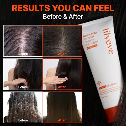 lilyeve GROWTURN Capsule Treatment – Squalane & Exosome Hair Growth Mask for Damaged Hair, Korean Scalp Treatment, Sulfate & Silicone Free, 7.78 fl oz Avelisse