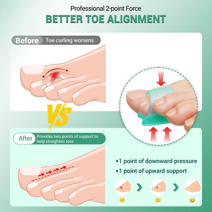 TASZOOS Hammer Toe Straightener Corrector for Women & Men - Gel Hammer Toe Straightener - Toe Splints - Realign Bent, Curled, Crooked, Claw, Hammer Toes - 3 Different Sizes (S/M/L) - 6pcs (Green)