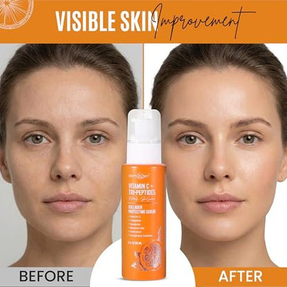 Dermaxgen Vitamin C + Tri-Peptide Bright Idea Serum – Skin Brightening & Anti-Aging Face Serum for Radiant, Firm Skin, Boosts Collagen & Elasticity, 2 fl oz Avelisse