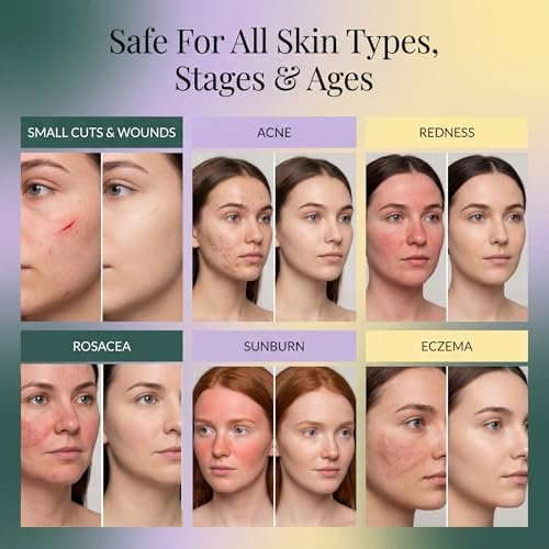 Jusspray Hypochlorous Acid Spray for Face and Skin – HOCI Facial Cleanser Mist – 32oz Refill for Acne, Eczema, Body Acne, Piercing Aftercare, Wound Solution Avelisse