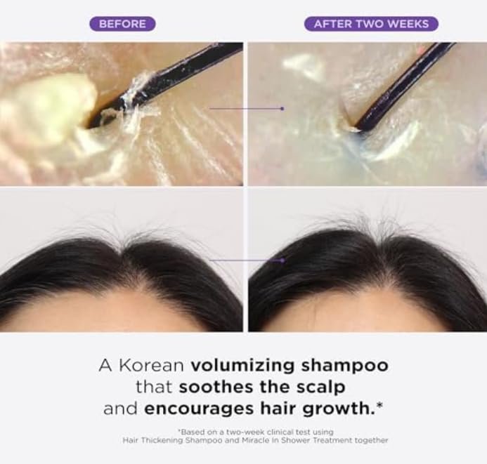 Dr Groot Scalp Revitalizing Solution Hair Thickening Shampoo - Volumizing & Strengthening Formula for All Scalp Types, Dermatologically Tested, 700 ml (23.66 fl oz) Avelisse