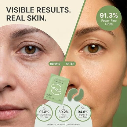 Koreana Skin Peptide Repair Eye Mask with PDRN & Hyaluronic Acid - Korean Under Eye Patches for Puffy Eyes & Dark Circles - Firming & Deeply Hydrating Eye Patches for Wrinkles - 5 Pairs - K-Beauty