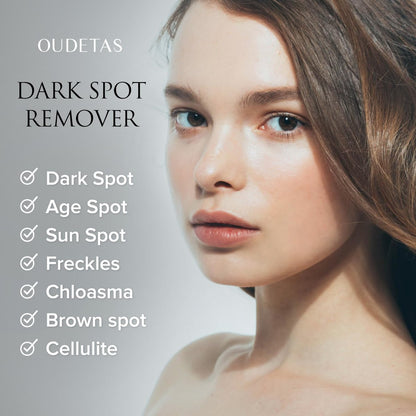 Dark Spot Remover for Face & Body – Sun & Age Spot Corrector, Melasma & Hyperpigmentation Brightening Serum with Roller (0.5 Fl Oz)