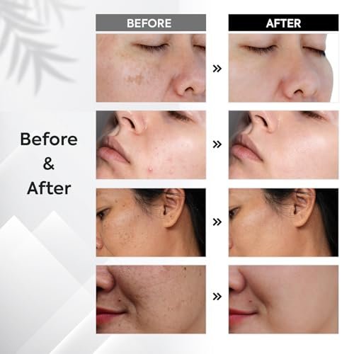 Dark Spot Remover for Face & Body – Sun & Age Spot Corrector, Melasma & Hyperpigmentation Brightening Serum with Roller (0.5 Fl Oz) - görsel 6