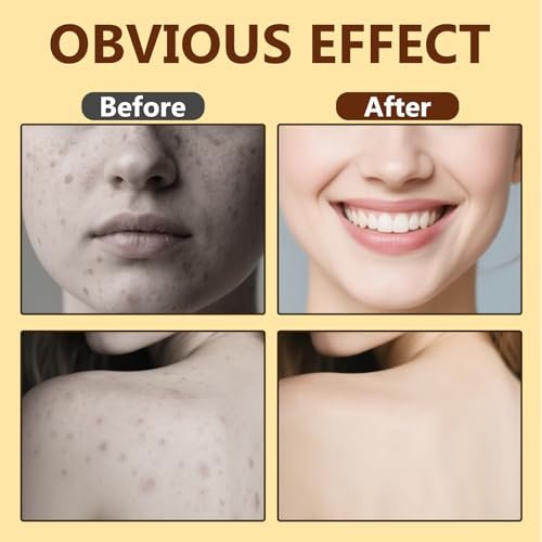 Bee Venom Skin Treatment Cream - Natural Formula Moisturizer for All Skin Types, 2.1 fl oz - görsel 12
