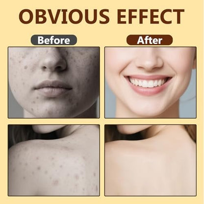 Bee Venom Skin Treatment Cream - Natural Formula Moisturizer for All Skin Types, 2.1 fl oz