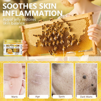 Bee Venom Skin Treatment Cream - Natural Formula Moisturizer for All Skin Types, 2.1 fl oz
