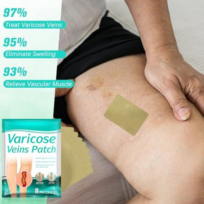 Diinou 2 Pack LegRenew Varicose Veins Patch - Professional Varicose Veins Treatment for Legs with Natural Ingredients