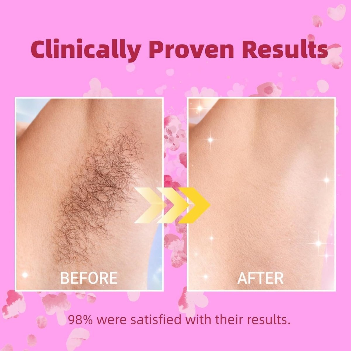 Cyperus Rotundus Oil - 60ml Natural Oil for Hair Removal, Moisturizing & Soothing, Reduces Body Hair Growth, All Skin Types Avelisse