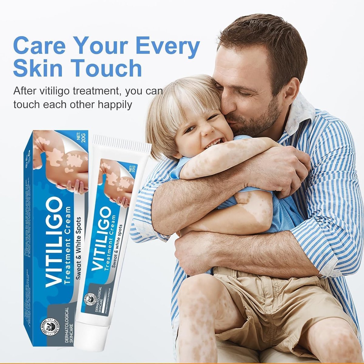 EXVITAMIN Vitiligo Cream – Natural Treatment for Pigmentation & Leukoplakia, Restore Skin Tone for Men & Women (0.7 oz) Avelisse