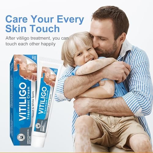 EXVITAMIN Vitiligo Cream – Natural Treatment for Pigmentation & Leukoplakia, Restore Skin Tone for Men & Women (0.7 oz) Avelisse