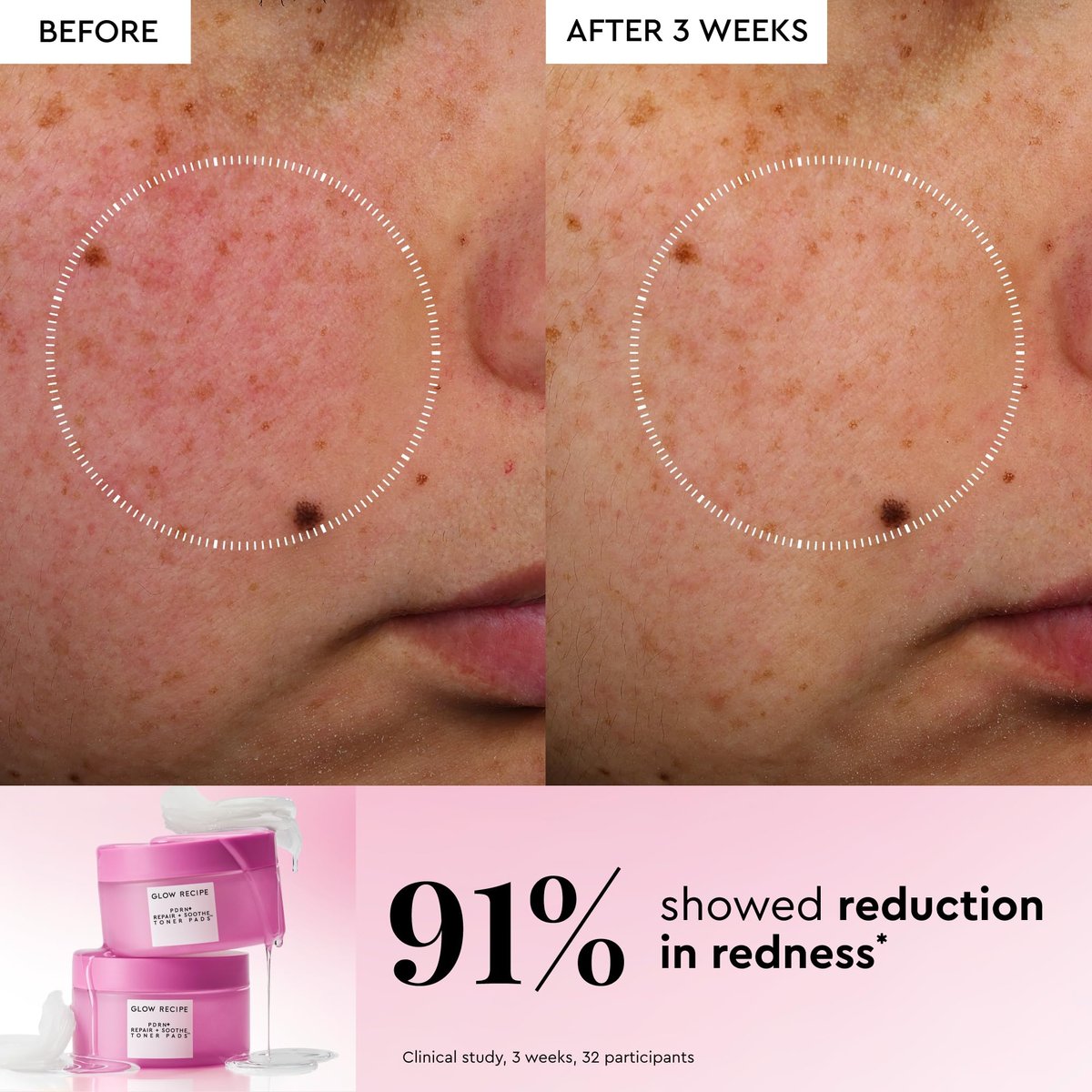 Glow Recipe PDRN+ Repair + Soothe Toner Pads - Fragrance-Free Face Toner Pads for Sensitive Skin - Barrier Repair, Redness Reducing + Calming Hydration with Centella - Korean Skin Care (60 Face Pads) Avelisse
